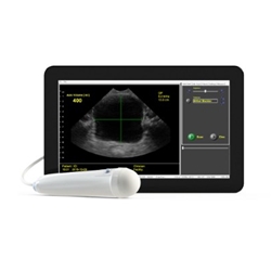 Bladder Scanner